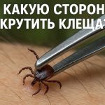 В какую сторону крутить клеща при удалении: советы экспертов для безопасной процедуры